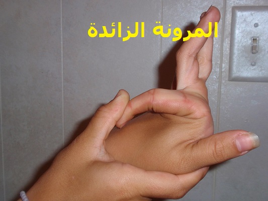 صورة